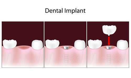 Heritage Dental